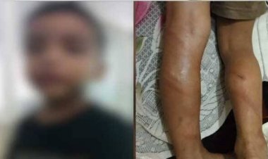 അക്ഷരമാല പഠിച്ചില്ല; കൊച്ചിയില്‍ നാലുവയസുകാരനെ ക്രൂരമായി തല്ലി ട്യൂഷന്‍ സാര്‍